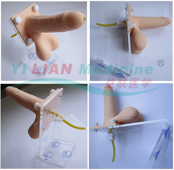 ���Ա����׾���(x��)ģ��