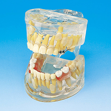 ͸�������l(f��)��ģ��