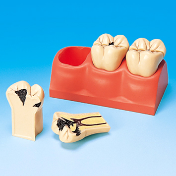 �x�X����ģ��