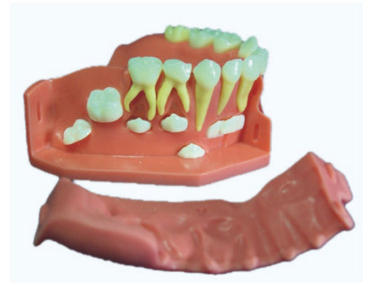 ���аl(f��)��ģ��