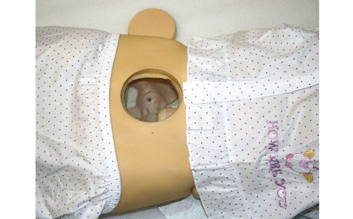 ����y��ģ��